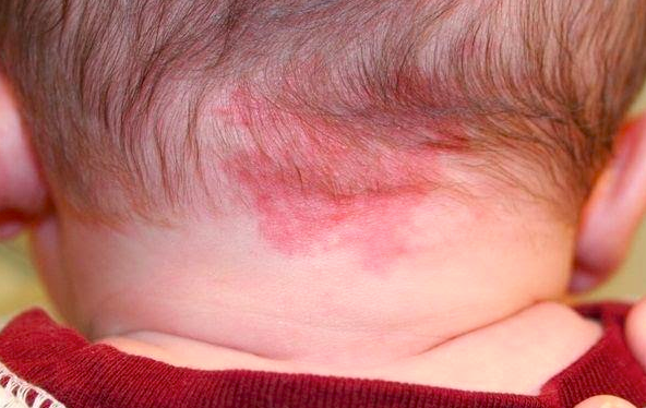 mancha salmão 1 .png