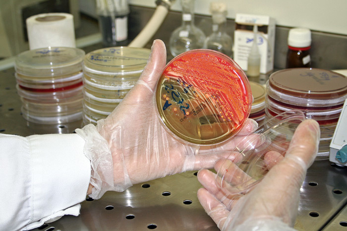 Análise Microbiológica da Água